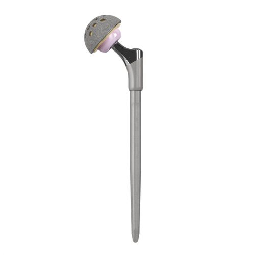Prótese de quadril de revisão - EXPRT® - Trilliant Surgical - não cimentada