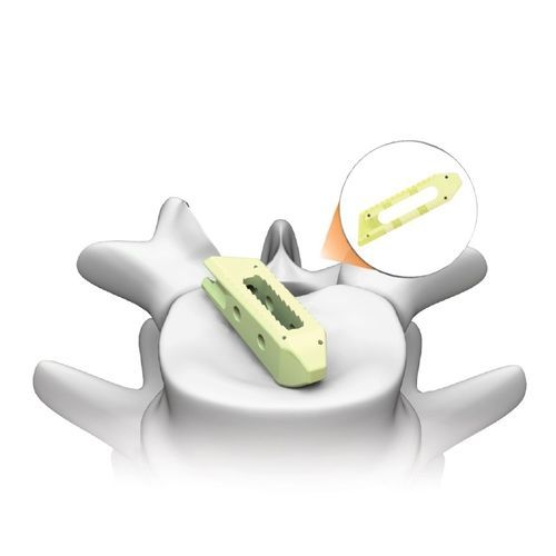 Espaçador intervertebral lombar - PLATEAU®-LO - Life Spine - via transforaminal / via oblíqua