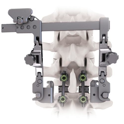 Afastador para cirurgia ortopédica - CALYPSO™ - Life Spine