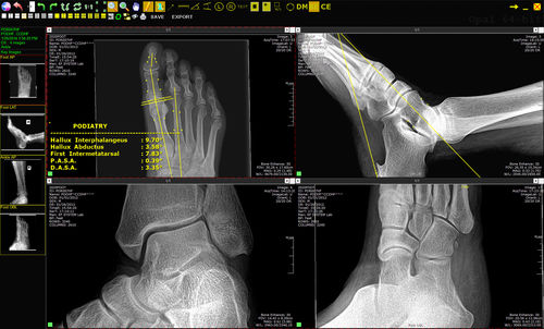 Sistema de transmissão para exames de imagem - Opal-RAD - 20/20 Imaging - de arquivamento