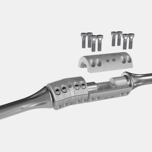 Haste intramedular para fêmur - OsteoBridge™ - Merete - para tíbia / para úmero / em titânio
