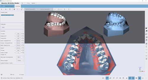 Software de análise - Ortho Studio - AGE Solutions - de visualização 3D / de medição / de tratamento