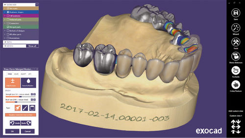 Software CAD - exocad ® - Shining 3D - de visualização 3D / de tratamento / de design digital de sorriso