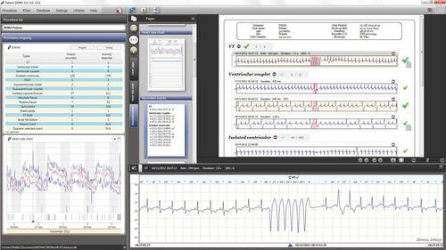 Software de criação de laudos - RTSoft Ultima - Novacor - de segurança / clínico
