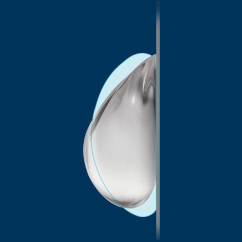Implante mamário - TruForm® 1 - Allergan - Natrelle - redondo / em silicone / em gel de silicone
