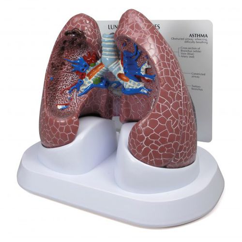 Modelo de pulmão - 3110 - GPI Anatomicals - para ensino / para câncer / para DPOC