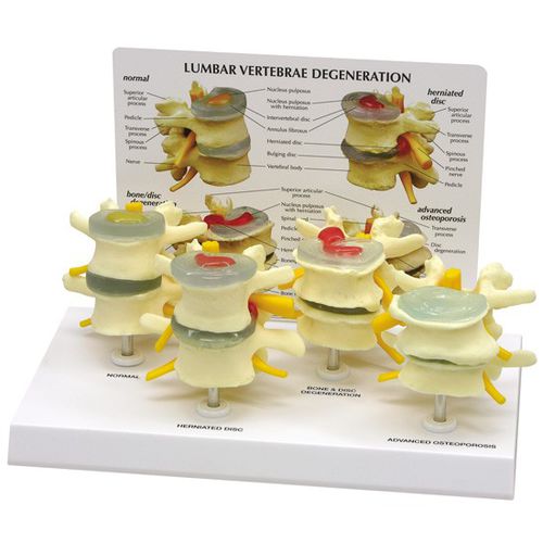 Modelo de disco intervertebral - 1760 - GPI Anatomicals - de osso / para ensino / de osteoporose