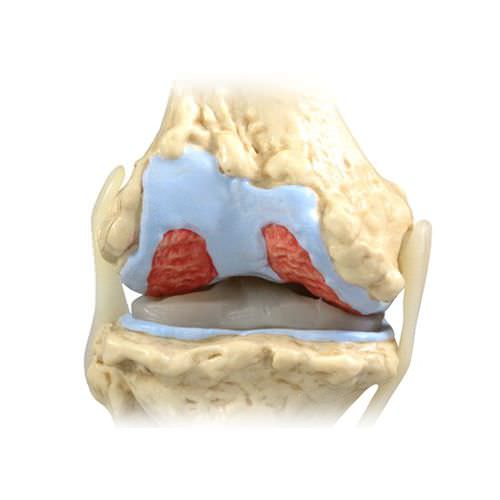 Modelo de articulação - 1100 - GPI Anatomicals - de joelho / para ensino