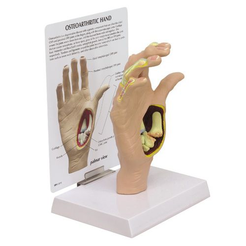 Modelo de osso - 1930 - GPI Anatomicals - de articulação / de mão / para ensino