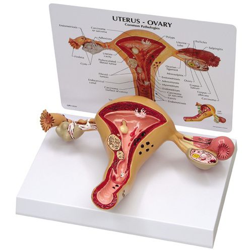 Modelo de útero - 3480 - GPI Anatomicals - de ovários / para ensino / feminino