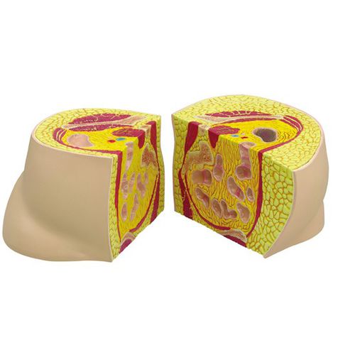 Modelo anatômico de quadril - 3600 - GPI Anatomicals - para ensino / para obesidade / para pessoas obesas