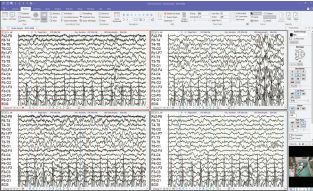 Software de gestão de dados - Profusion™ - Dr. Grossegger & Drbal alpha trace medical systems - de monitorização / de gravação / de teste