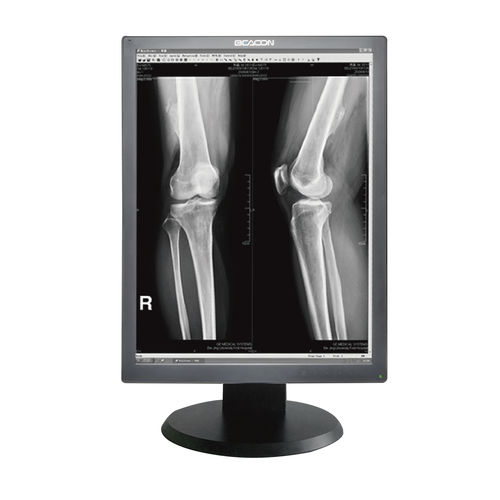 Monitor médico - G23S+ - Shenzhen Beacon Display Technology - de diagnóstico / de alta definição / 21,3"