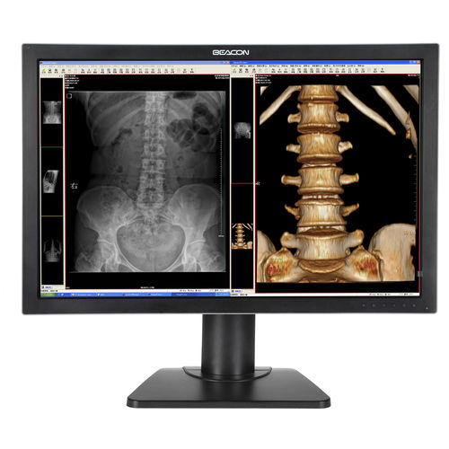 Monitor médico - C44W+ - Shenzhen Beacon Display Technology - de diagnóstico / de alta definição / 30"
