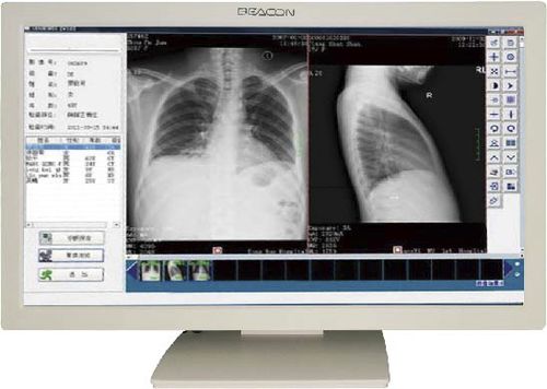Monitor médico - C22W - Shenzhen Beacon Display Technology - 1920 x 1080 / 21,5" / LED