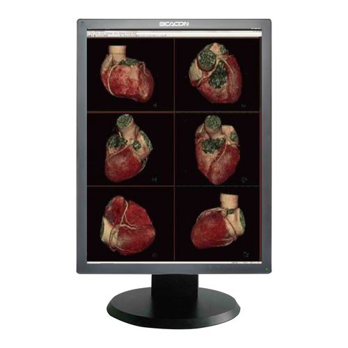 Monitor médico - C22S+ - Shenzhen Beacon Display Technology - para exames de imagem / 21,3" / LED