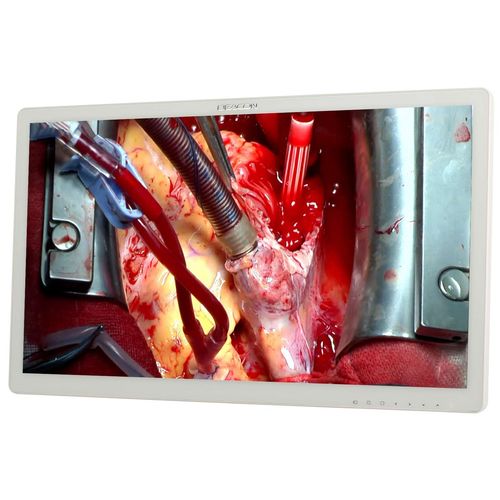 Monitor cirúrgico - S271P - Shenzhen Beacon Display Technology - 1920 x 1080 / 27" / LED