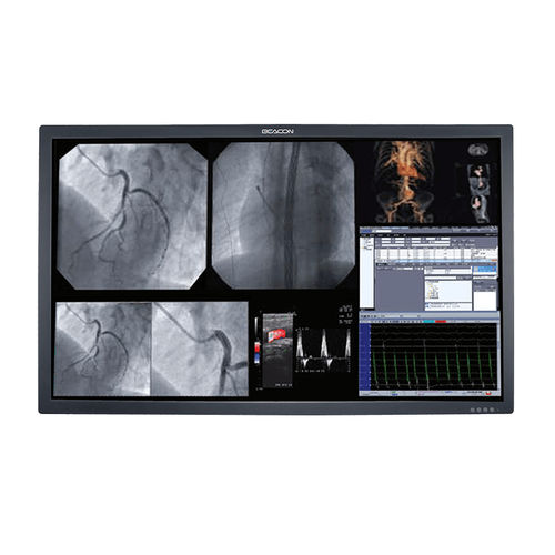 Monitor médico - S556P - Shenzhen Beacon Display Technology - 3840 x 2160 / 55" / de alta luminosidade