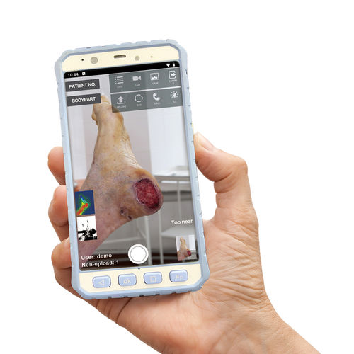 Aplicativo para iOS de análise - MPD100 - Medimaging Integrated Solution - de registro clínico / de pele / com inteligência artificial