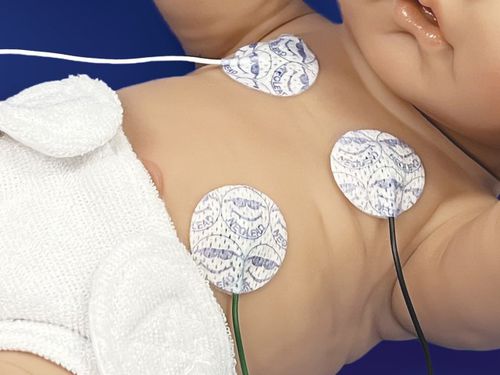 Eletrodo de ECG infantil - NeoLead® - Neotech Products