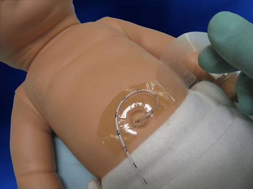 Fixador de tubo de intubação - Hold-A-Line™ - Neotech Products