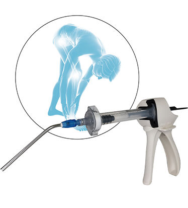 Substituto ósseo sintético - QUICKSET® - NORAKER - para cirurgia ortopédica / moldável / em pasta