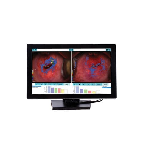 Software de análise - DYSISmap - DySIS Medical - de gestão / didático / de avaliação