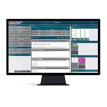 Sistema de informação para laboratório de histopatologia - CaseManager DX - 3DHISTECH Ltd. - de gestão
