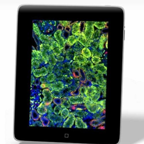 Aplicativo para iOS para laboratório de histopatologia - iPad Viewer - 3DHISTECH Ltd. - para microscopia virtual / visualizador / para treinamento