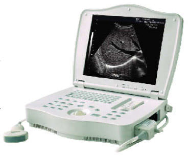 Aparelho de ultrassom portátil - LEO-3000E1  - Xuzhou Leo Medical Equipments - geral / em preto e branco / com console integrada