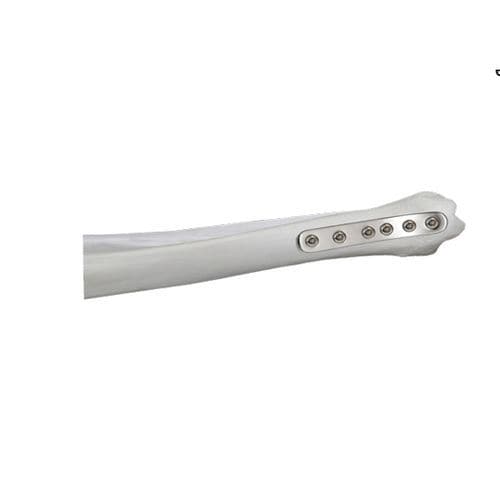 Placa de compressão óssea para tíbia - 37.804.2 series - Medicalex - distal / medial / bloqueada