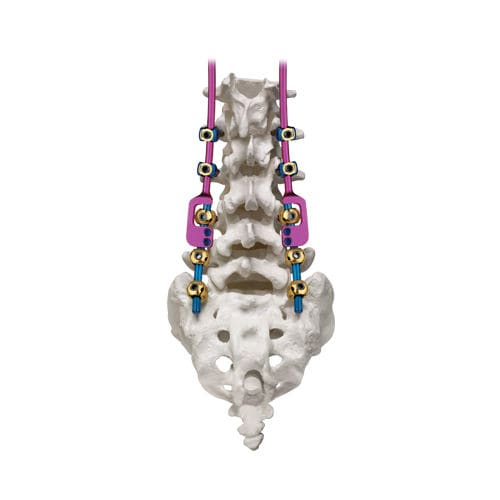 Sistema de osteossíntese toracolombossacral - REVERE® ADDITION® - Globus Medical - via posterior