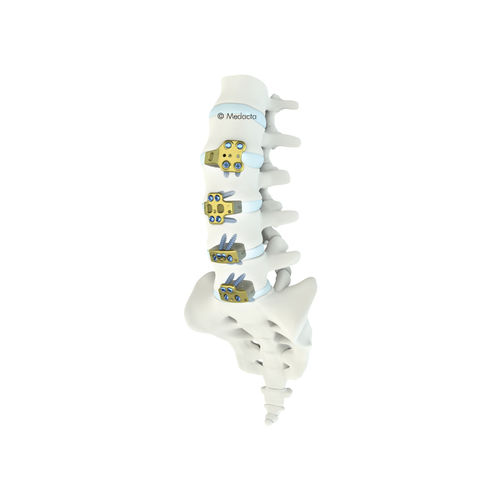 Espaçador intervertebral toracolombar - MectaLIF® - Medacta - via anterior / em titânio