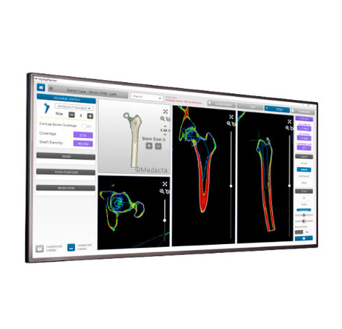 Software de análise - MyHip® - Medacta - de planejamento / para TC / de quadril