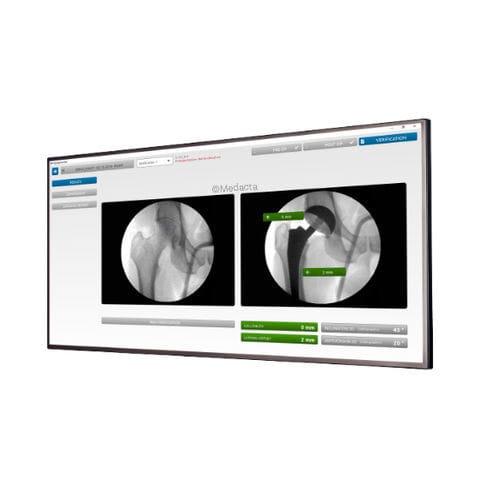 Software de verificação - MyHip® - Medacta - para cirurgia da anca / de quadril / para tablet