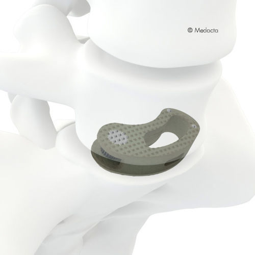 Espaçador intervertebral toracolombar - MectaLIF® - Medacta - via oblíqua / em titânio / em PEEK