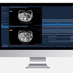 Módulo de software para oncologia - Myrian® XL-Onco - Intrasense - de análise / de gestão / de medição