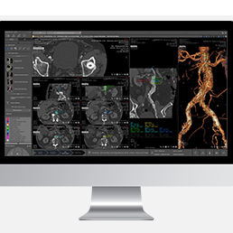 Módulo de software médico-hospitalar - Myrian® XP-Vessel - Intrasense - de análise / de visualização / de planejamento