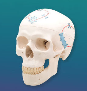 Sistema de fixação craniana não absorvível - NeuroPro®  - Kinamed