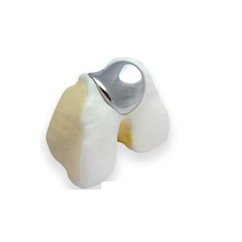 Prótese femoropatelar - KineMatch® - Kinamed