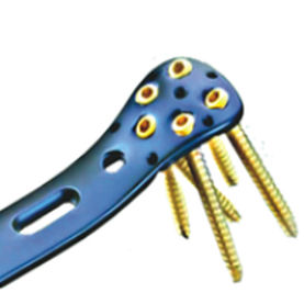 Placa de compressão óssea para fêmur - ORTHO CARE - proximal / metálica