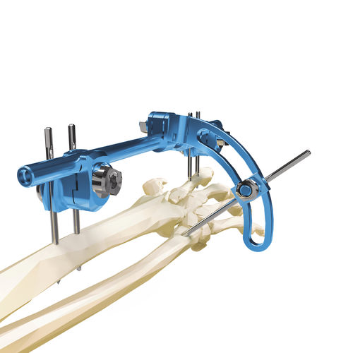 Fixador externo para punho - 5002007ST - MIKAI - para rádio / para cúbito / híbrido