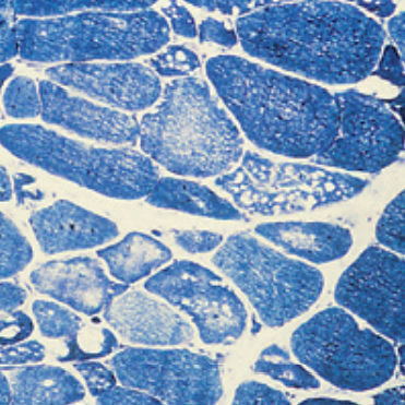 Reagente solução de coloração - 30-30116LY  - BIO-OPTICA Milano - para histologia