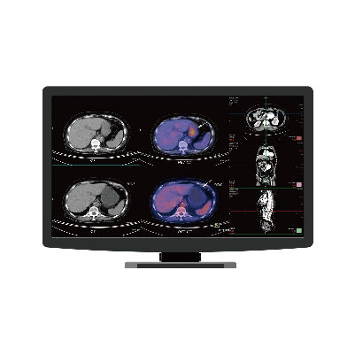 Monitor para mamografia - CR22 - Nanjing Jusha Display Technology - de alta definição / 21,5" / com retroiluminação LED