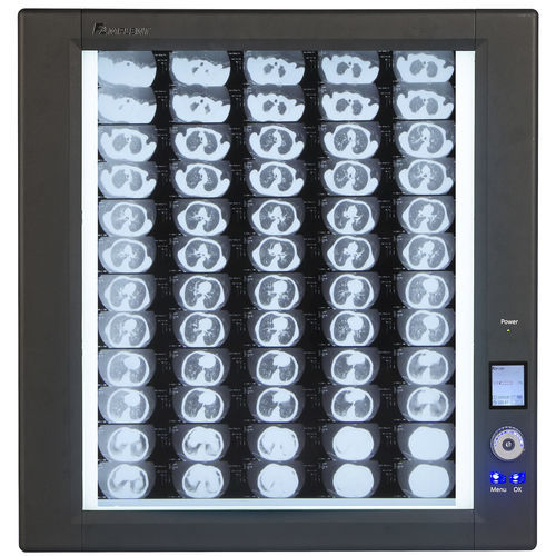 Negatoscópio digital - Trimline - Wolf X-Ray Corporation - 1 corpo / 2 corpos / 4 corpos