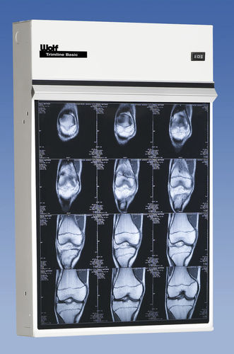 Negatoscópio convencional - Trimline Basic - Wolf X-Ray Corporation - vários corpos
