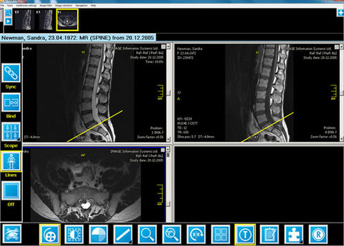 Software de criação de laudos - iQ-VIEW/PRO - IMAGE Information Systems - de visualização / de importação / para radiologia