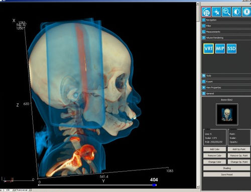 Módulo de software de visualização 3D - iQ-3D - IMAGE Information Systems - de pós-processamento / para exames de imagem / para tablet