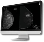 software para tomossíntese mamária