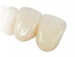 pr&oacute;tese dent&aacute;ria em zirc&ocirc;nia